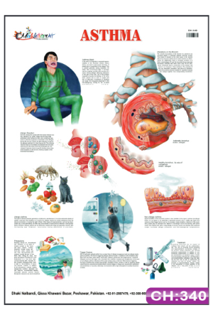 Asthma Chart